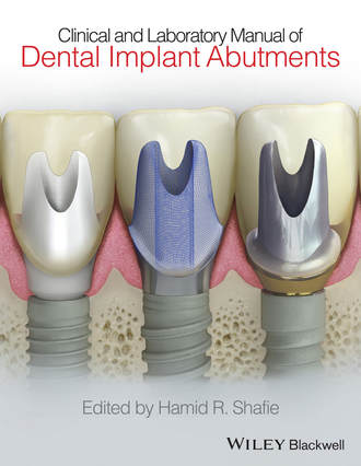 Hamid R. Shafie. Clinical and Laboratory Manual of Dental Implant Abutments