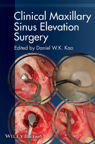 Группа авторов. Clinical Maxillary Sinus Elevation Surgery