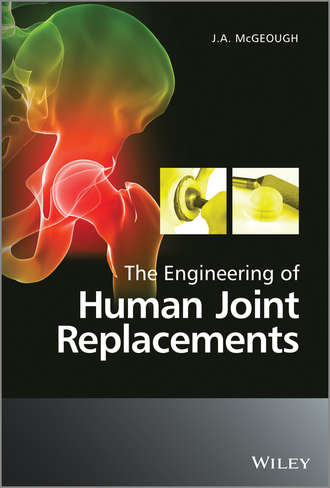 J. A. McGeough. The Engineering of Human Joint Replacements