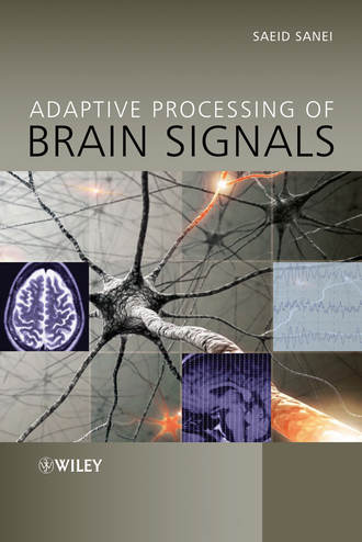 Saeid Sanei. Adaptive Processing of Brain Signals