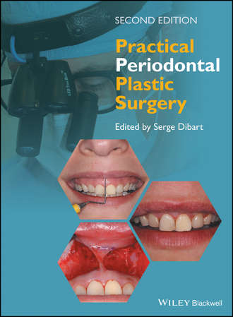 Группа авторов. Practical Periodontal Plastic Surgery