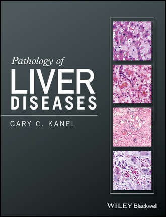 Gary C. Kanel. Pathology of Liver Diseases