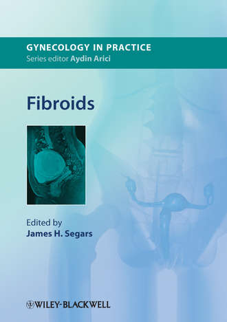 Группа авторов. Fibroids
