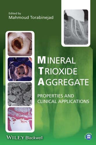 Mineral Trioxide Aggregate. Mahmoud Torabinejad