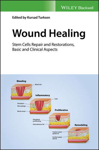 Wound Healing. Группа авторов