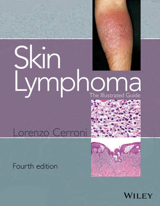 Lorenzo Cerroni. Skin Lymphoma