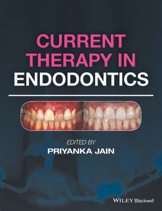 Группа авторов. Current Therapy in Endodontics