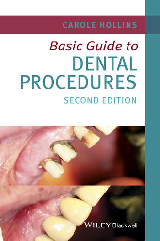 Basic Guide to Dental Procedures. Carole Hollins