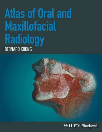 Atlas of Oral and Maxillofacial Radiology. Bernard Koong