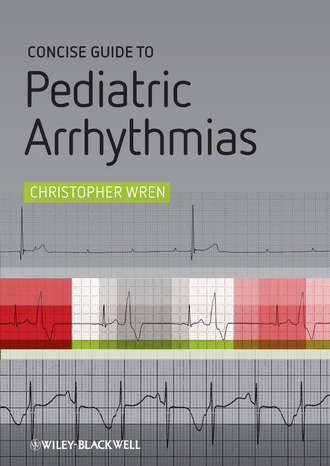 Concise Guide to Pediatric Arrhythmias. Christopher Wren