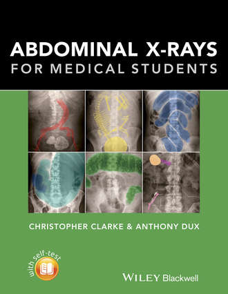 Christopher Clarke. Abdominal X-rays for Medical Students