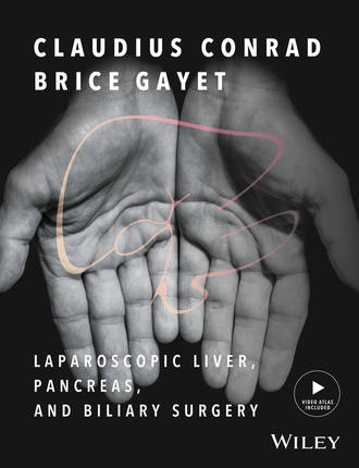 Группа авторов. Laparoscopic Liver, Pancreas, and Biliary Surgery