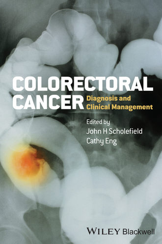Группа авторов. Colorectal Cancer