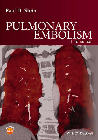 Pulmonary Embolism. Paul D. Stein
