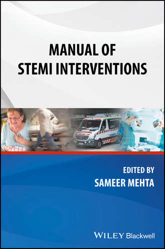 Группа авторов. Manual of STEMI Interventions