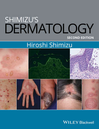 Hiroshi Shimizu. Shimizu's Dermatology