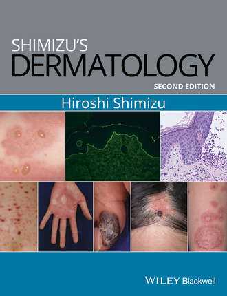 Shimizu's Dermatology. Hiroshi Shimizu