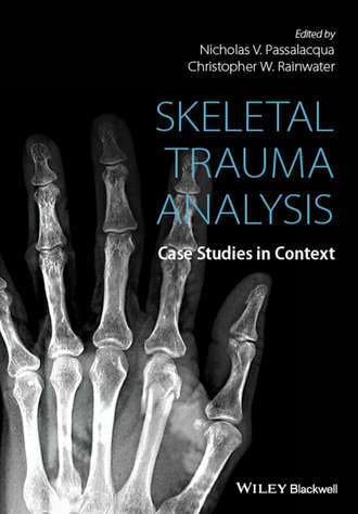 Группа авторов. Skeletal Trauma Analysis