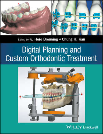 Группа авторов. Digital Planning and Custom Orthodontic Treatment