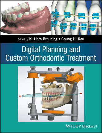 Digital Planning and Custom Orthodontic Treatment. Группа авторов