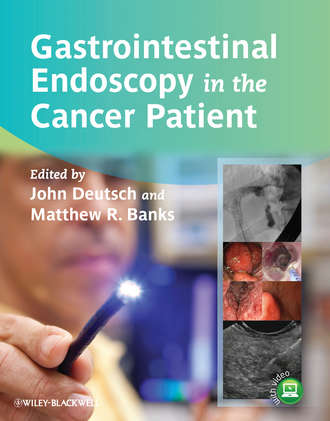 Группа авторов. Gastrointestinal Endoscopy in the Cancer Patient
