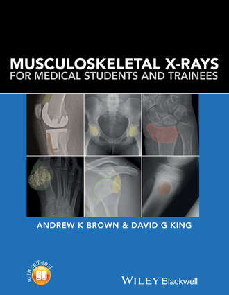 Andrew K. Brown. Musculoskeletal X-Rays for Medical Students and Trainees