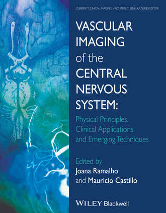Группа авторов. Vascular Imaging of the Central Nervous System