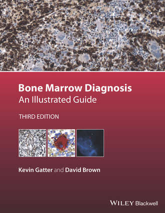 David Brown. Bone Marrow Diagnosis