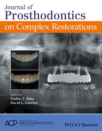 Группа авторов. Journal of Prosthodontics on Complex Restorations