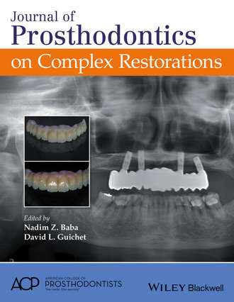 Journal of Prosthodontics on Complex Restorations. Группа авторов