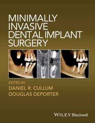 Группа авторов. Minimally Invasive Dental Implant Surgery