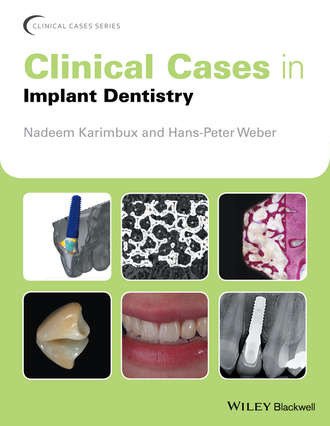 Группа авторов. Clinical Cases in Implant Dentistry