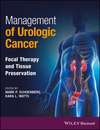 Группа авторов. Management of Urologic Cancer