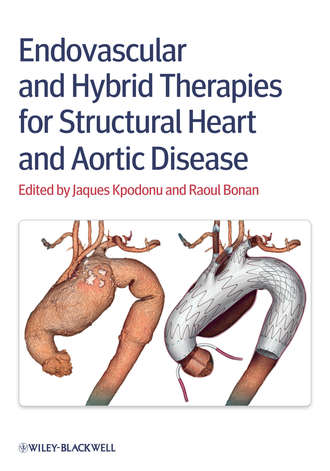 Группа авторов. Endovascular and Hybrid Therapies for Structural Heart and Aortic Disease