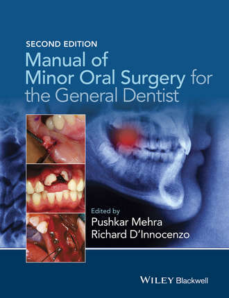 Manual of Minor Oral Surgery for the General Dentist. Pushkar Mehra