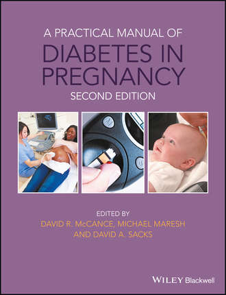 Группа авторов. A Practical Manual of Diabetes in Pregnancy