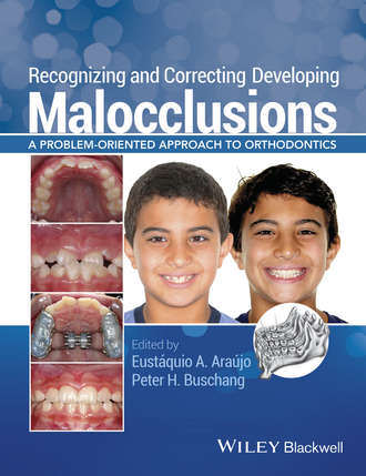 Группа авторов. Recognizing and Correcting Developing Malocclusions
