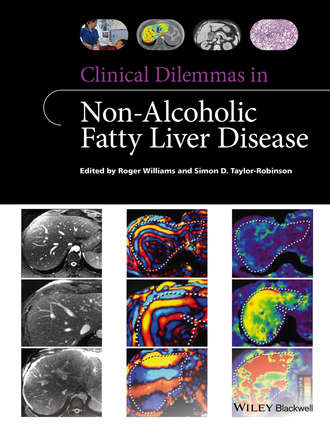 Roger  Williams. Clinical Dilemmas in Non-Alcoholic Fatty Liver Disease