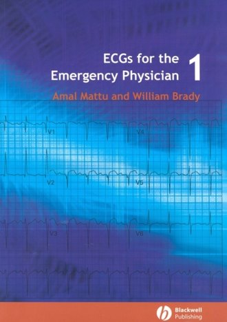 Amal Mattu. ECGs for the Emergency Physician 1