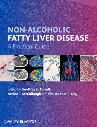 Группа авторов. Non-Alcoholic Fatty Liver Disease