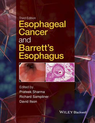 Группа авторов. Esophageal Cancer and Barrett's Esophagus