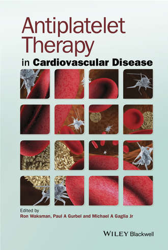 Группа авторов. Antiplatelet Therapy in Cardiovascular Disease
