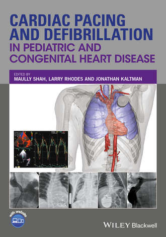 Группа авторов. Cardiac Pacing and Defibrillation in Pediatric and Congenital Heart Disease