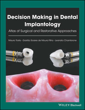 Mauro Tosta. Decision Making in Dental Implantology