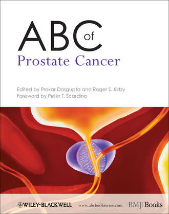 Prokar Dasgupta. ABC of Prostate Cancer