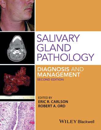 Eric R. Carlson. Salivary Gland Pathology