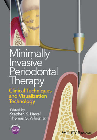 Stephen K. Harrel. Minimally Invasive Periodontal Therapy