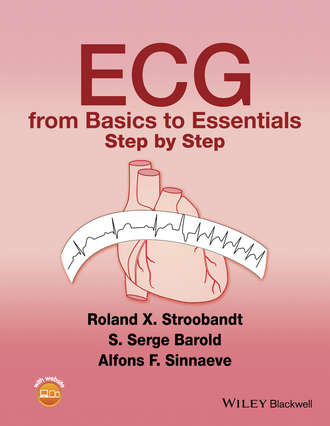 S. Serge Barold. ECG from Basics to Essentials