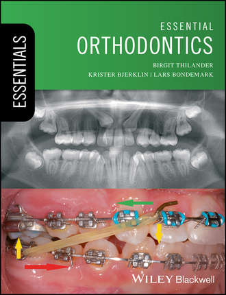Essential Orthodontics. Birgit Thilander