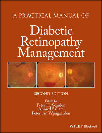 Группа авторов. A Practical Manual of Diabetic Retinopathy Management